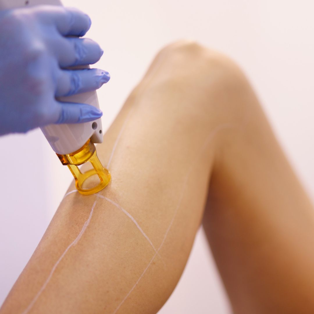 Practical Laser Hair Removal Workshop Only