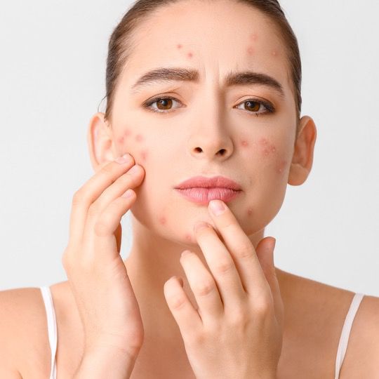 5-Berry Pigment Control Peel