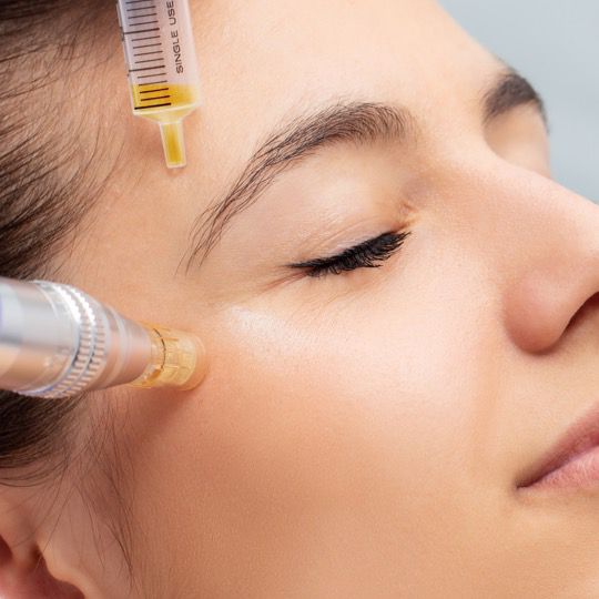 Skin Needling and LED Light Therapy