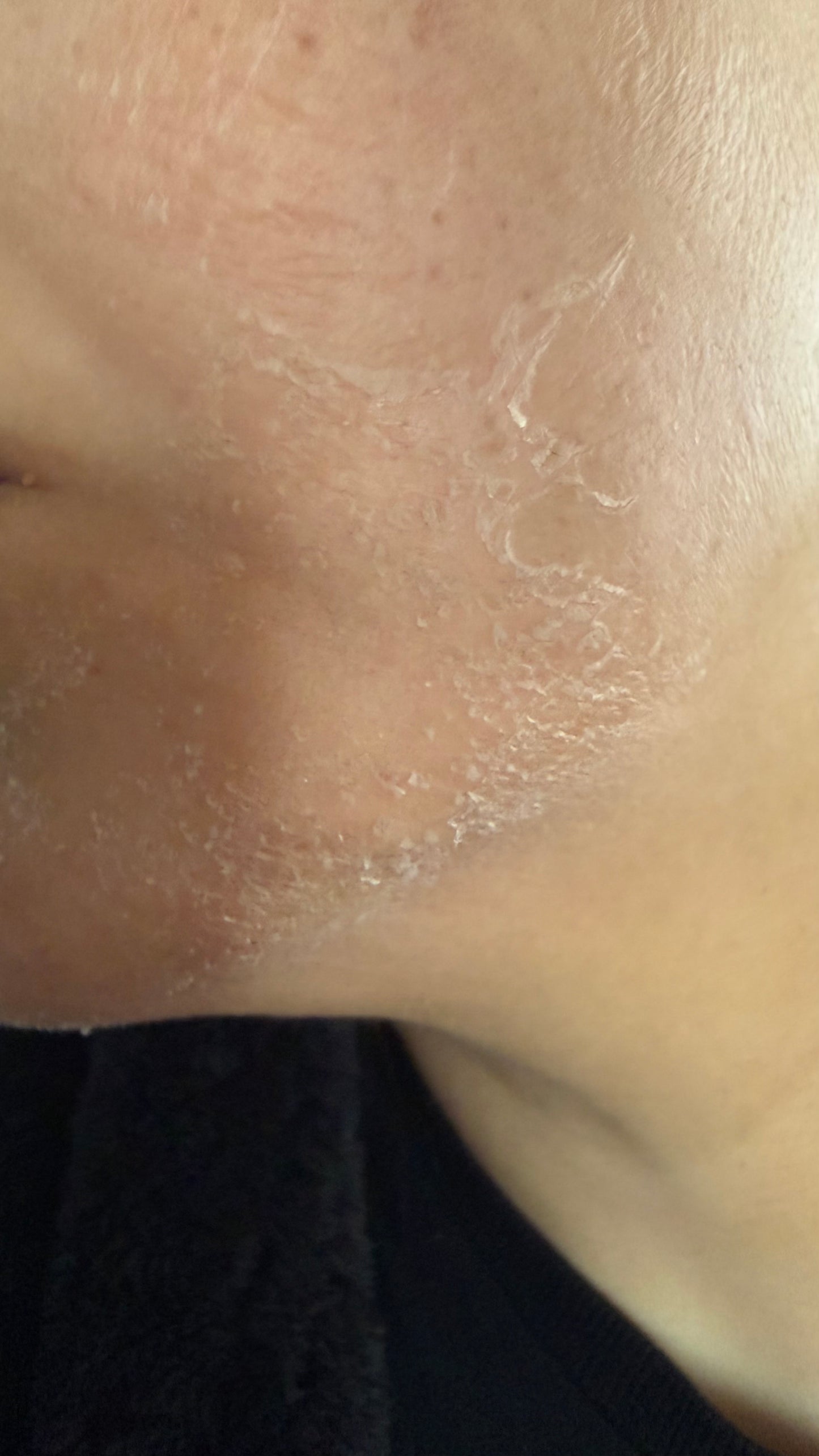 Kashaf Skin Reveal Peel