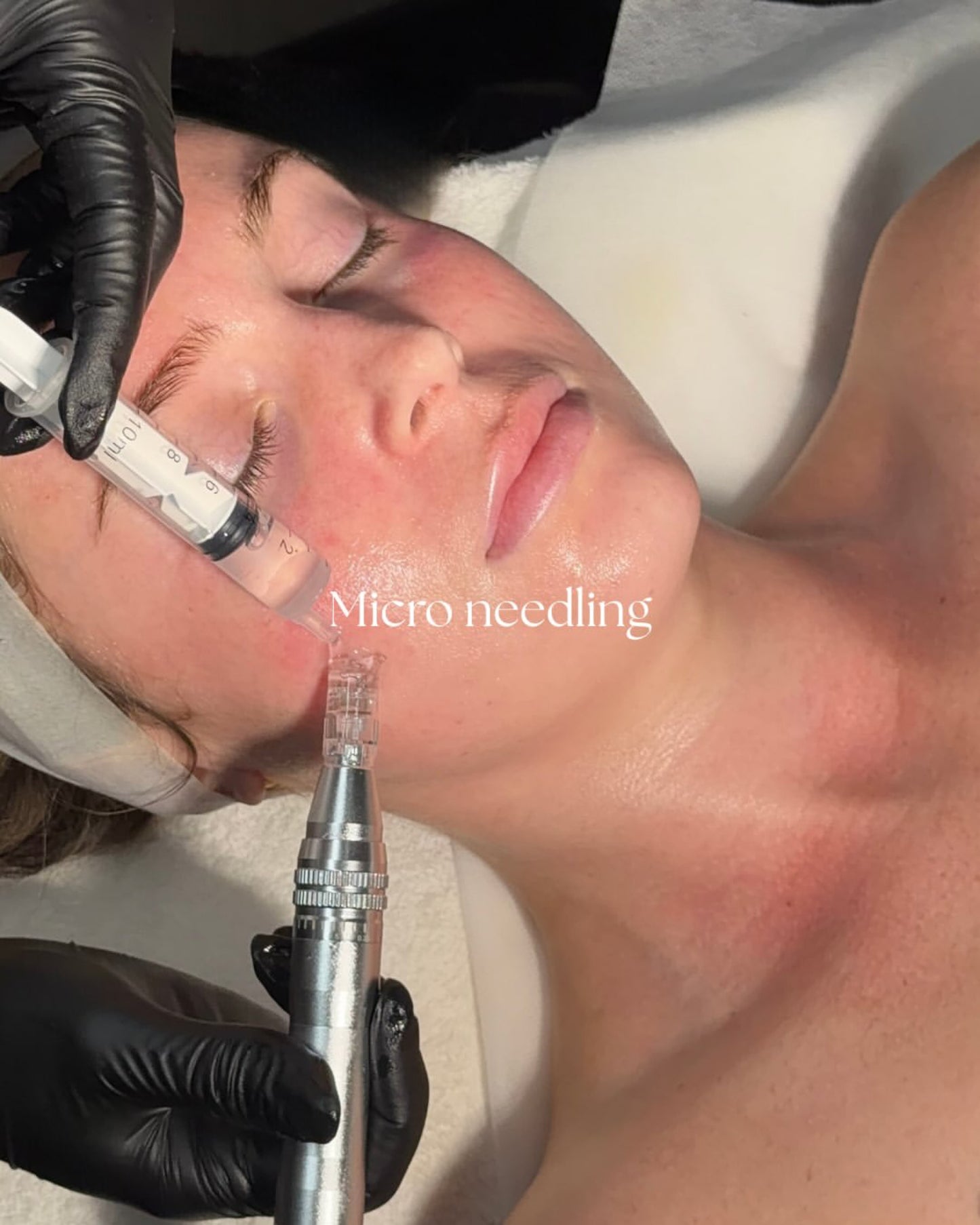 SAA Glass Skin Facial