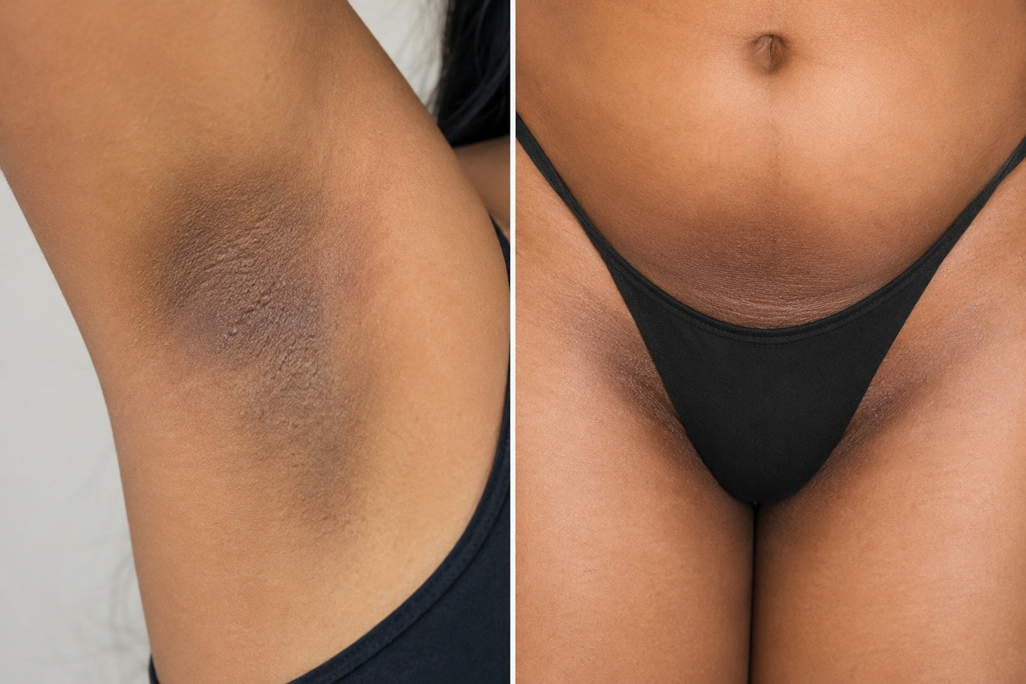 Lightening for Underarm or Intimate Area