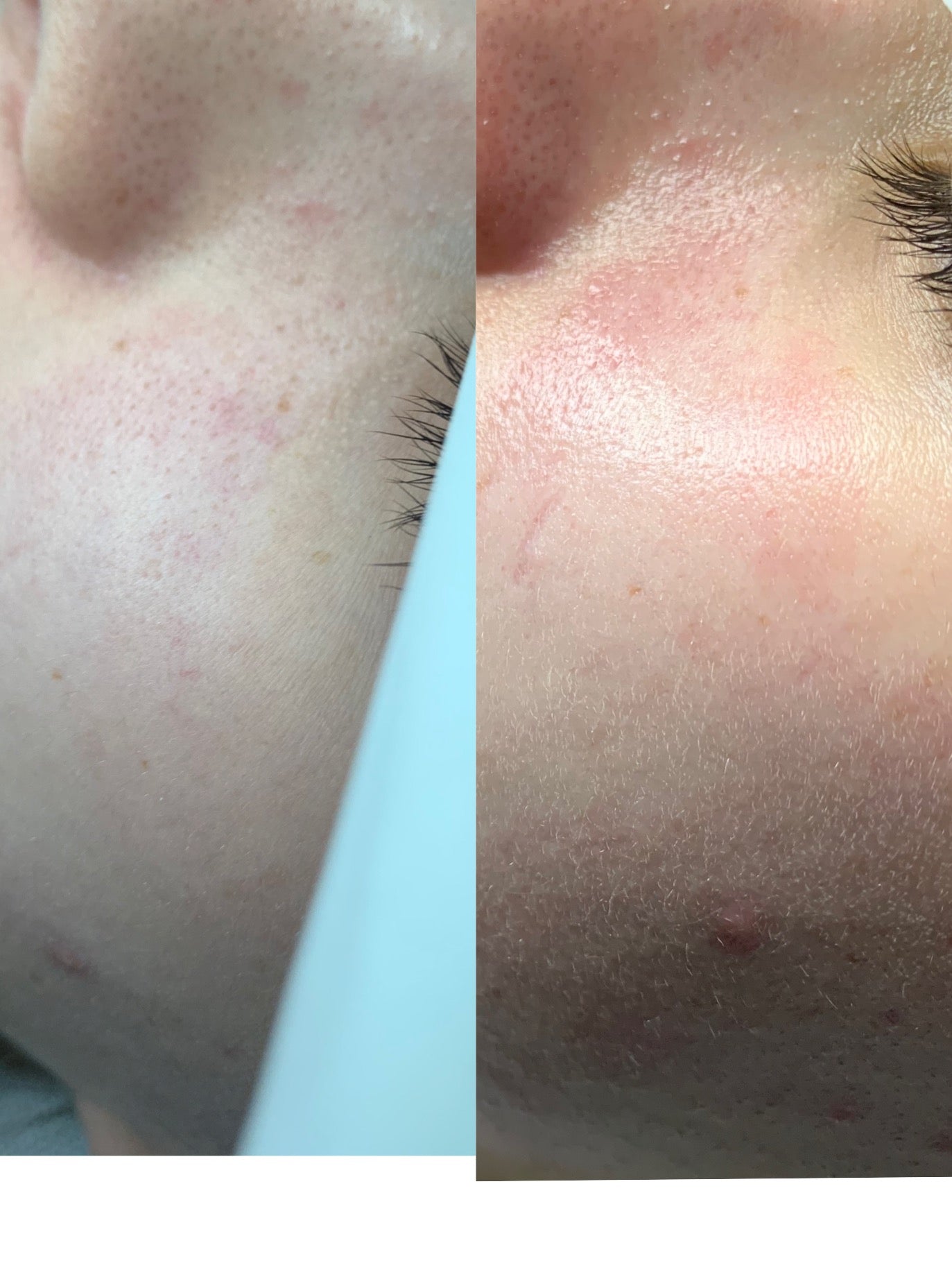 All in One Facial 45mins