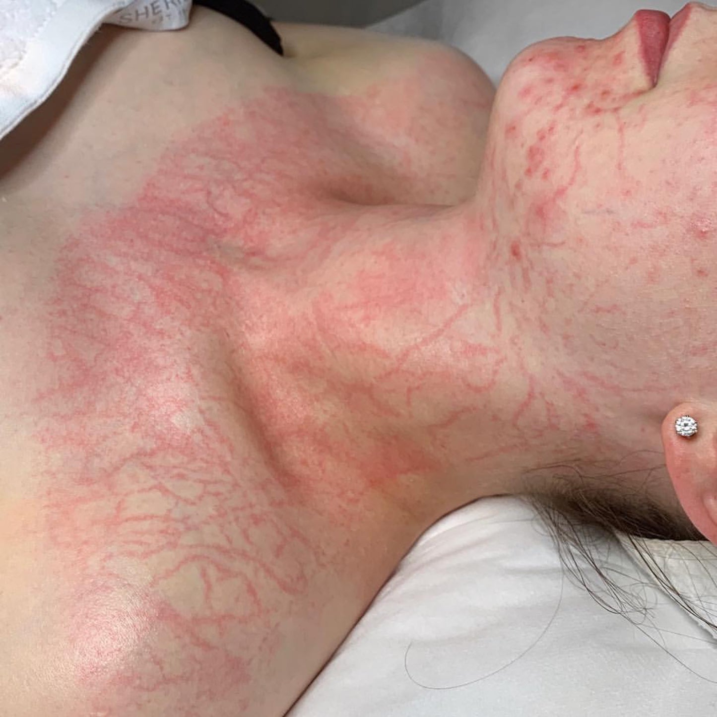Prin  Enyzme Lymphatic Drainage  Facial