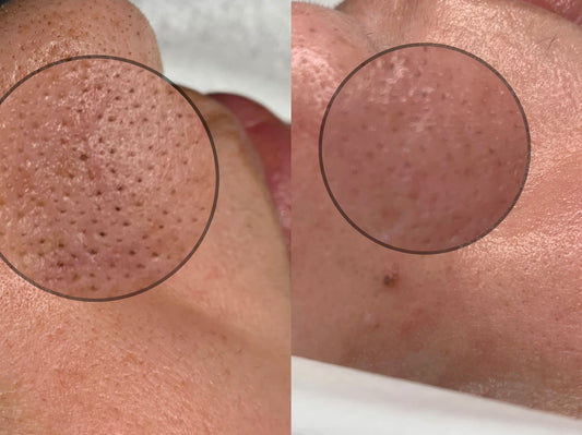 All in One Facial 45mins