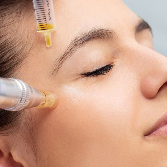 Skin Needling
