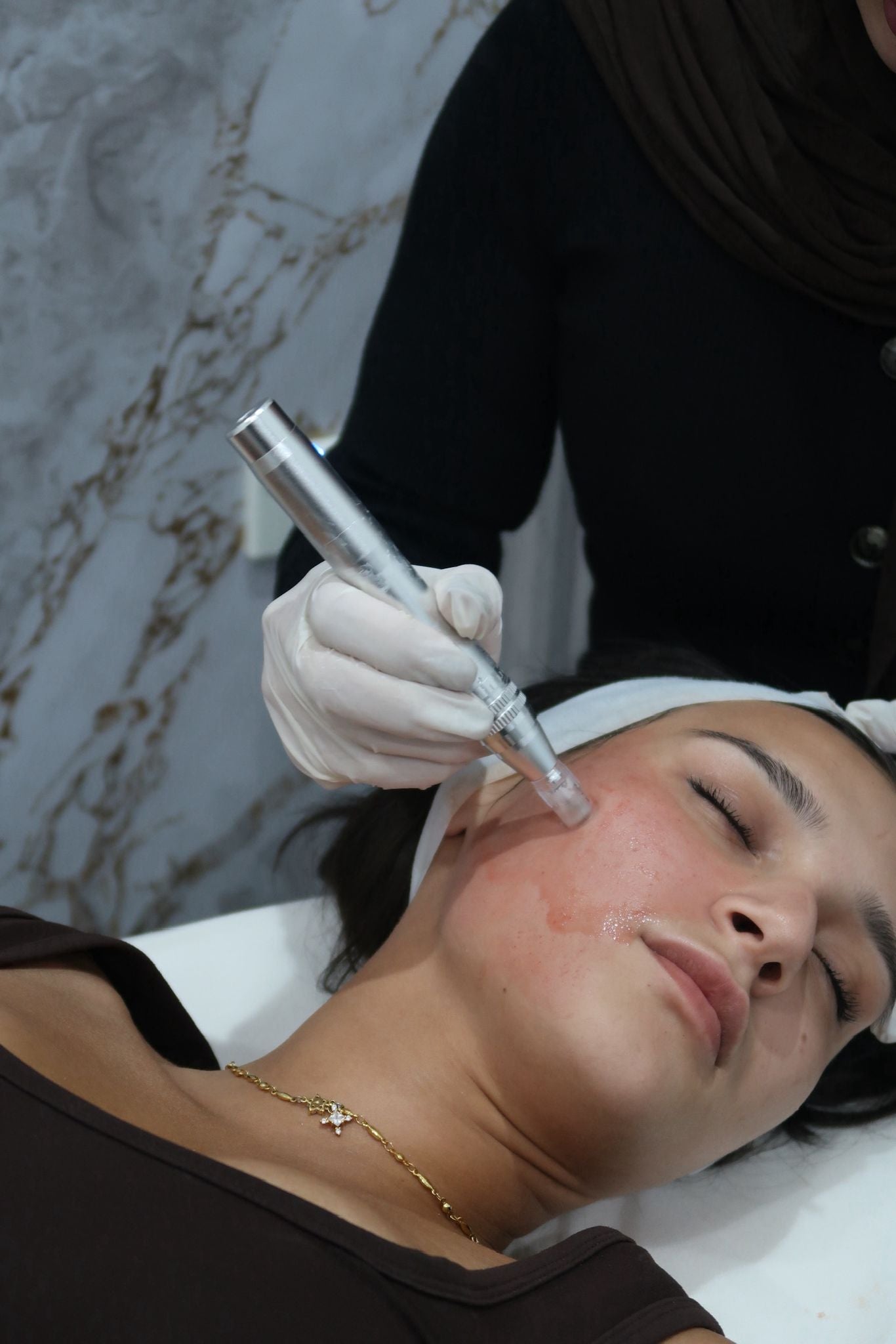 REJURAN® Booster Skin Needling